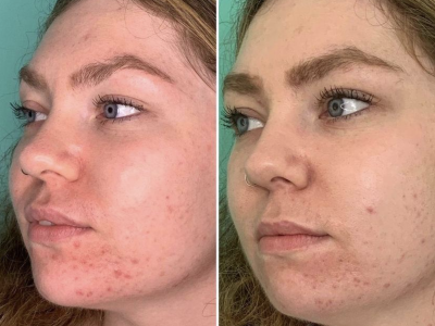 Screenshot 2025-03-04 at 6.17.50 PM